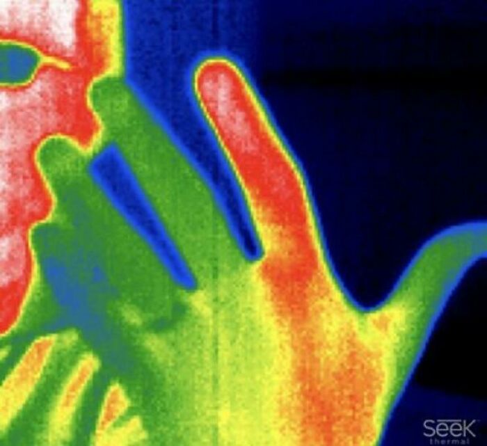 Thermal image showing heat distribution on a person's hand and face, illustrating medical photos capturing unique body conditions.