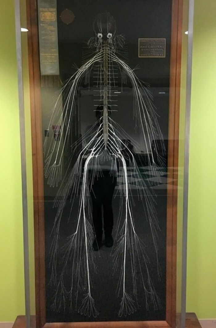 Human nervous system specimen displayed in a glass case, showcasing detailed nerve pathways in a medical photo.
