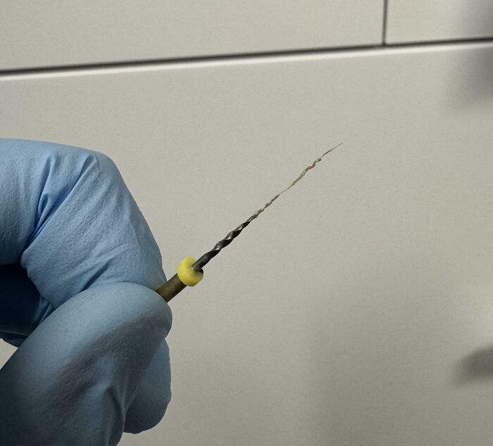 Close-up of a gloved hand holding a twisted dental file, a medical tool used in root canal treatments.