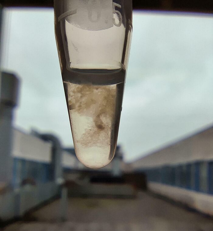 Close-up of a medical sample tube showing unusual sediment, illustrating fascinating and disturbing medical photos.