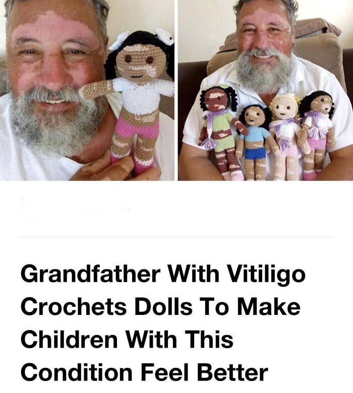 Grandfather with vitiligo holding crocheted dolls representing diverse skin tones celebrating beauty of planet earth.