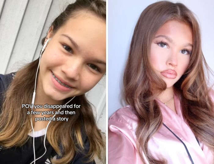 Side-by-side before and after photos of a young woman illustrating returning to social media after a hiatus.