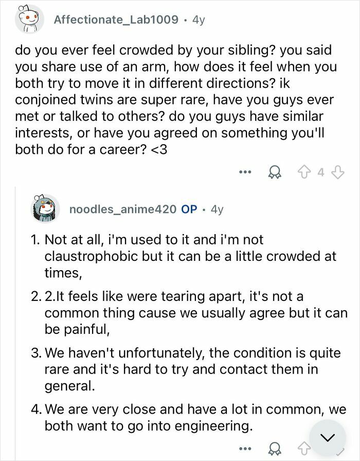 Reddit Q&A where conjoined twins discuss shared arm movement, rare condition, and career plans in engineering.