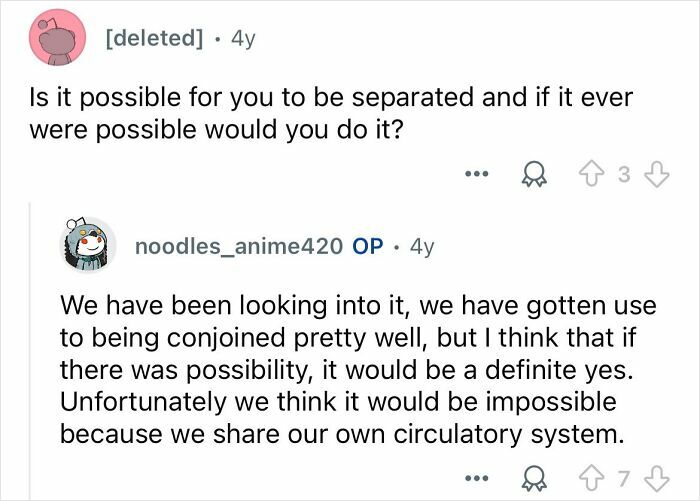 Reddit Q&A where conjoined twins discuss the possibility of separation and their shared circulatory system details.