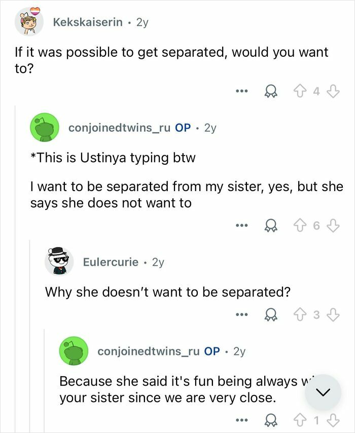 Reddit Q&A with conjoined twins discussing separation and sibling closeness in response to people's interesting questions.
