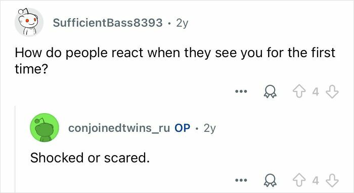 Reddit interaction showing conjoined twins answering how people react when seeing them for the first time.