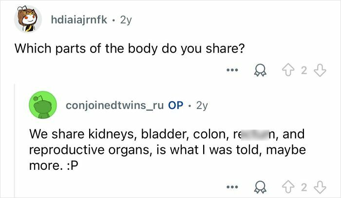 Reddit Q&A showing conjoined twins answering a question about which body parts they share in a detailed reply.