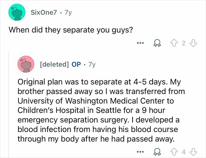 Screenshot of a Reddit Q&A about conjoined twins discussing emergency separation surgery and related health challenges.