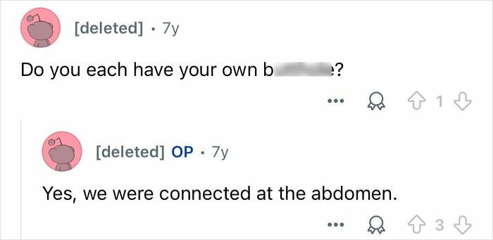 Screenshot of an online Q&A where conjoined twins answer questions about their anatomy and connection at the abdomen.
