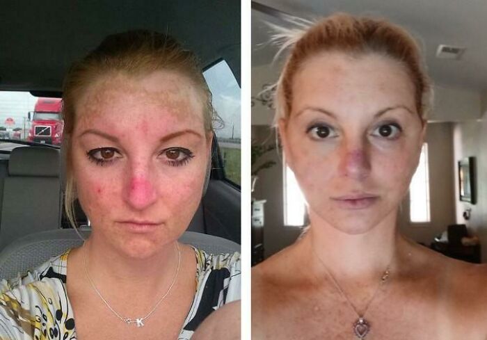 Before and after plastic surgery photos showing transformation from a casual look to a glamorous Beverly Hills appearance.