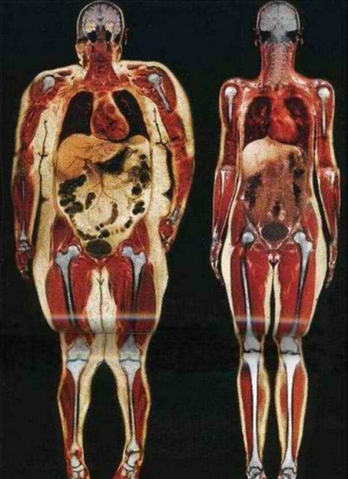 MRI scans showing extraordinary and fascinating body compositions side by side for intriguing comparison.