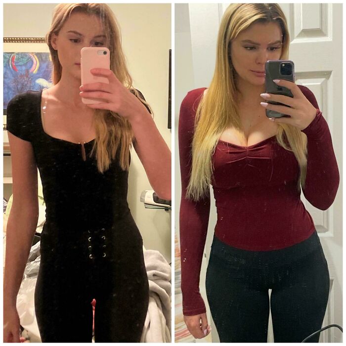 Side-by-side before and after plastic surgery photos showing transformation from a casual look to a glamorous style.