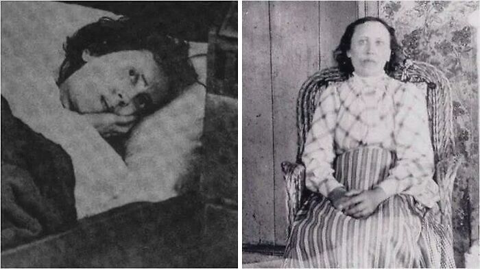 Two vintage photos showing a resting woman and another woman seated in a striped dress, extraordinary sights captured.