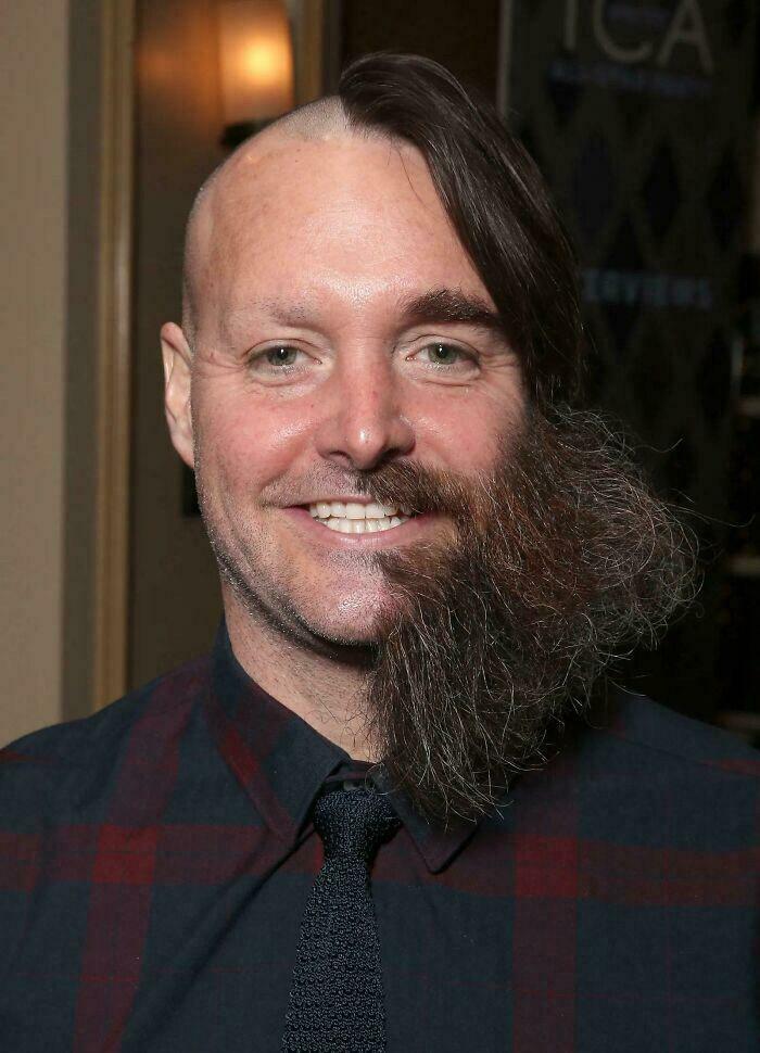 A man with a half-shaved head, long side hair, and half a beard, showcasing an unfortunate haircut.