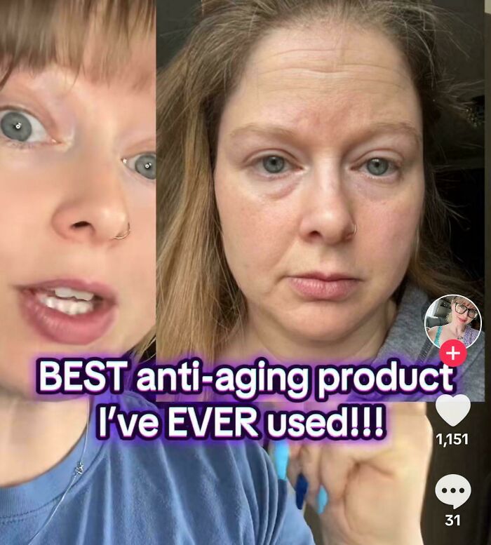 Split image showing Instagram vs reality of a woman promoting anti-aging product with noticeable skin differences.