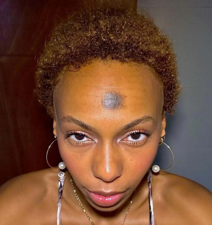 Close-up of a woman showing an interesting birth mark on her forehead with hoop earrings and curly hair.
