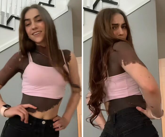 Young woman proudly showing her amazing and interesting birth marks on arms and torso in casual indoor setting