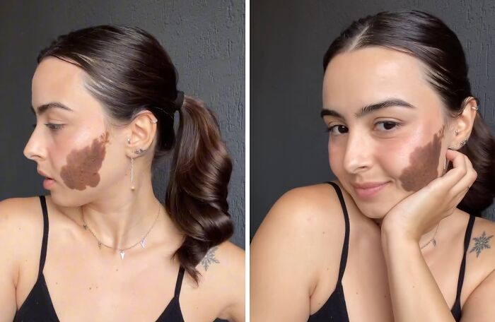 Young woman with a large birthmark on her cheek posing in black tank top, showcasing amazing and interesting birth marks.
