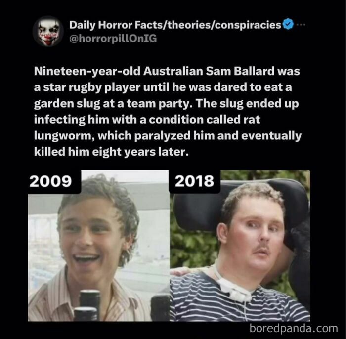 Before and after images showing the tragic effects of rat lungworm on a young man from the horror pill online group.