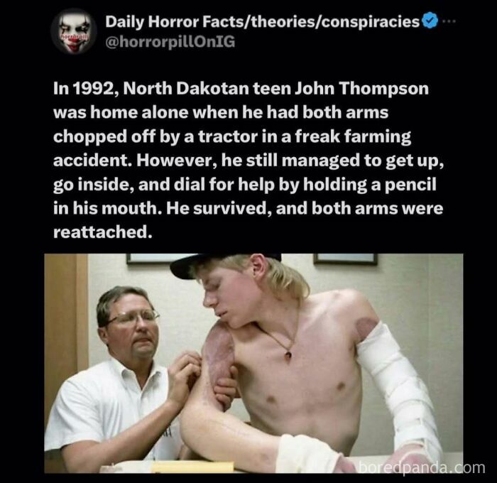 Teen survivor of tractor accident with reattached arms, featured in unsettling horror pill online group story.