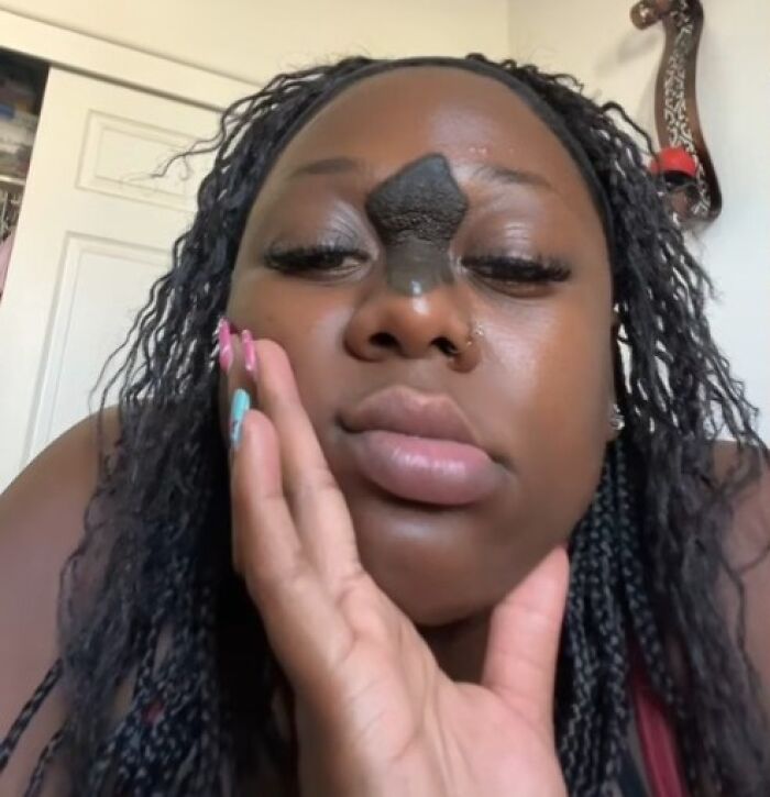Woman with a large unique birthmark on her forehead resting her face on her hand, showcasing interesting birth marks.