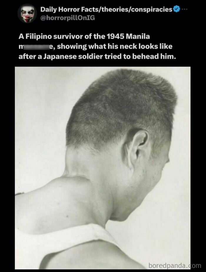 Filipino survivor showing neck injury after a Japanese soldier tried to behead him, from the horror pill online group.