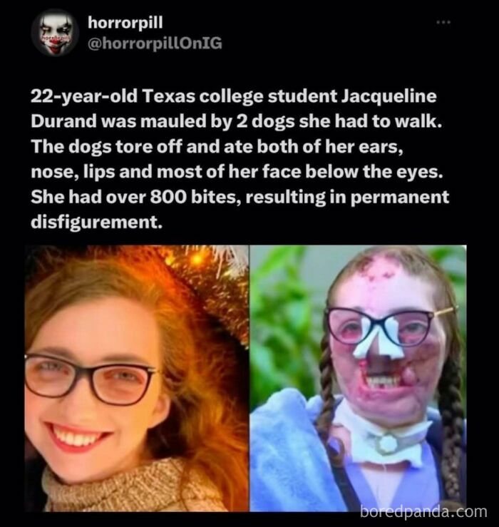 Before and after images of a Texas student showing permanent disfigurement from a severe dog mauling, unsettling horror pill content.