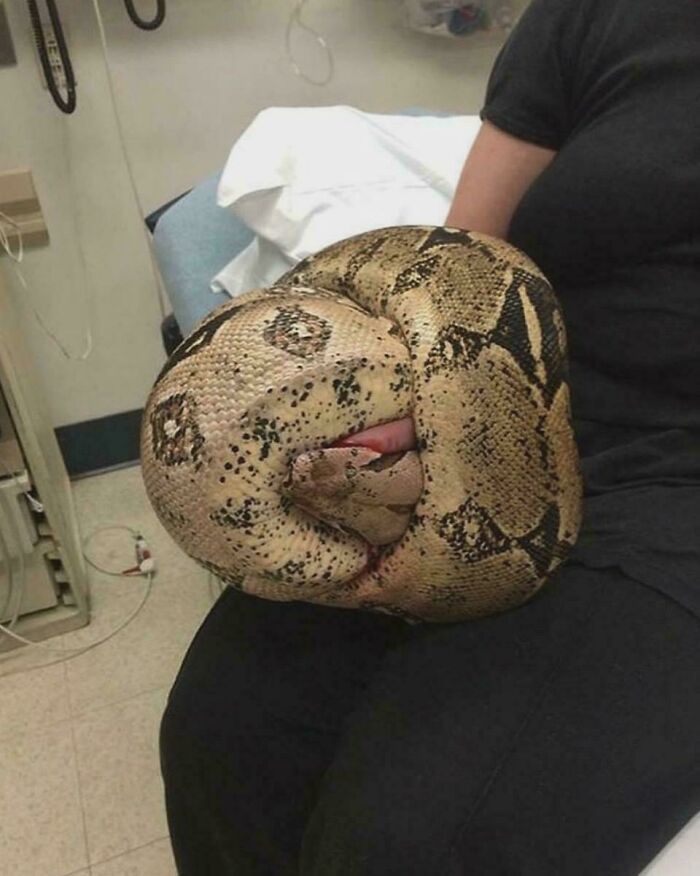 Huge python tightly coiled on a patient's arm in an exam room, unnerving scene, medical pics