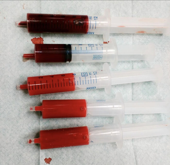 Row of syringes containing blood on clinical pad, medical pics close-up, unsettling