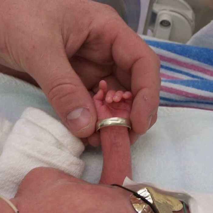 medical pics: adult hands holding extremely premature newborn's tiny hand and forearm with wedding ring in NICU