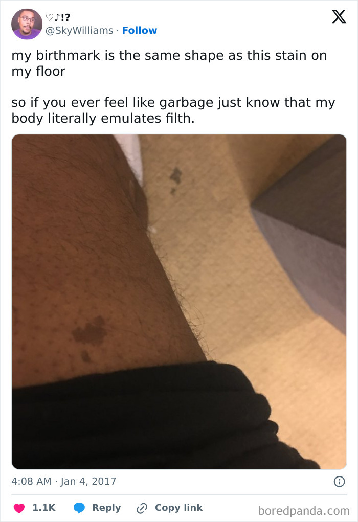 Person’s leg showing an interesting birthmark matching a stain on the floor, highlighting unique birth marks.