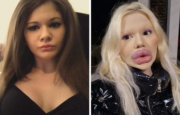 Before and after photos of a woman who became famous for extreme plastic surgery transformations.