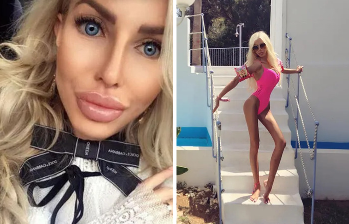 Woman with extreme plastic surgery and enhanced features posing in a pink swimsuit by outdoor stairs, illustrating fame transformation.