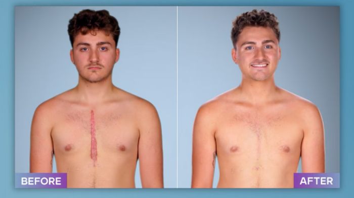 Young man showing before and after photos of plastic surgery correction by a surgeon who fixes botched operations.