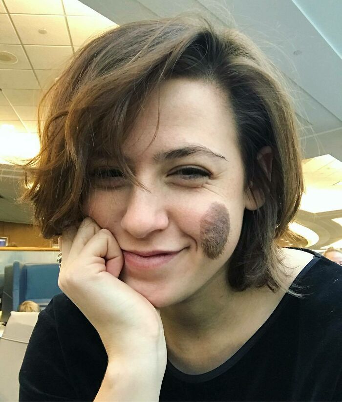 Young woman smiling in a casual setting, showing an interesting and unique birth mark on her cheek.