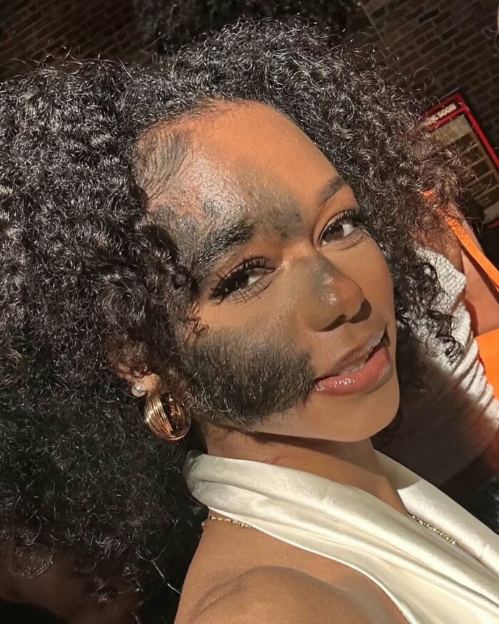 Woman with a large, unique birth mark on her face smiling with curly hair and gold hoop earrings in sunlight