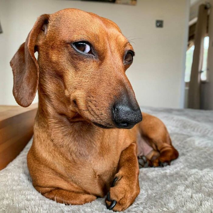 Unphotogenic dachshund dog with a skeptical expression lying on a bed, one eye half-closed humorously.