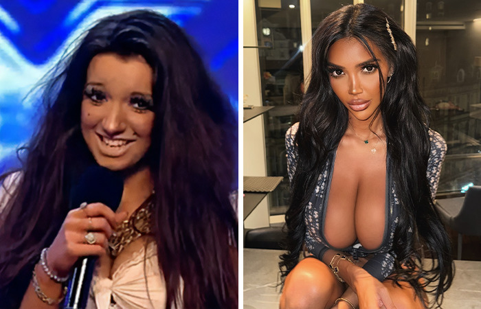 Before and after photos of a woman showing extreme plastic surgery transformation of normal people who shot to fame.