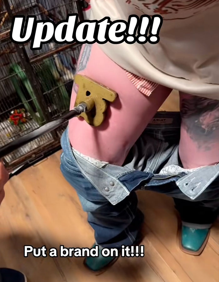 Person receiving freeze branding tattoo on thigh using a heated metal branding iron, highlighting risks warned by doctors. Person receiving freeze branding tattoo on thigh using a heated metal branding iron, highlighting risks warned by doctors.