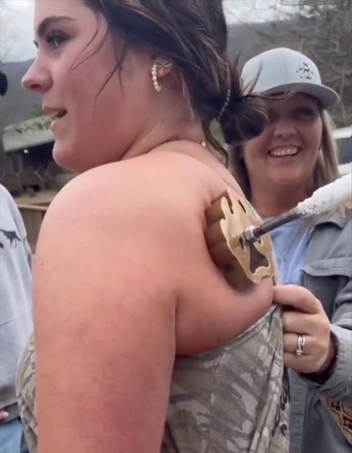 A woman receiving the trendy freeze branding tattoo alternative on her shoulder, with others watching nearby outdoors. A woman receiving the trendy freeze branding tattoo alternative on her shoulder, with others watching nearby outdoors.