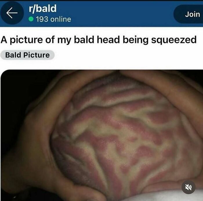 Close-up of a bald head being squeezed showing skin folds and texture from chaotic memes collection.