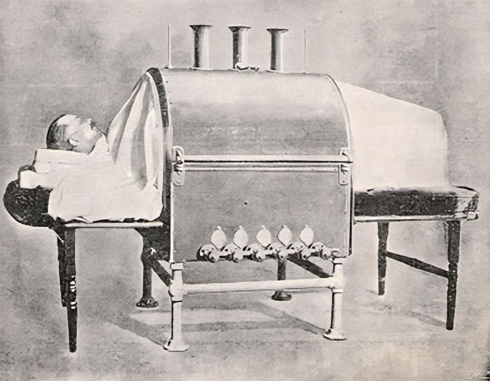 Vintage unsettling medical device with patient inside metal enclosure, illustrating eerie tools from the past in medical history.
