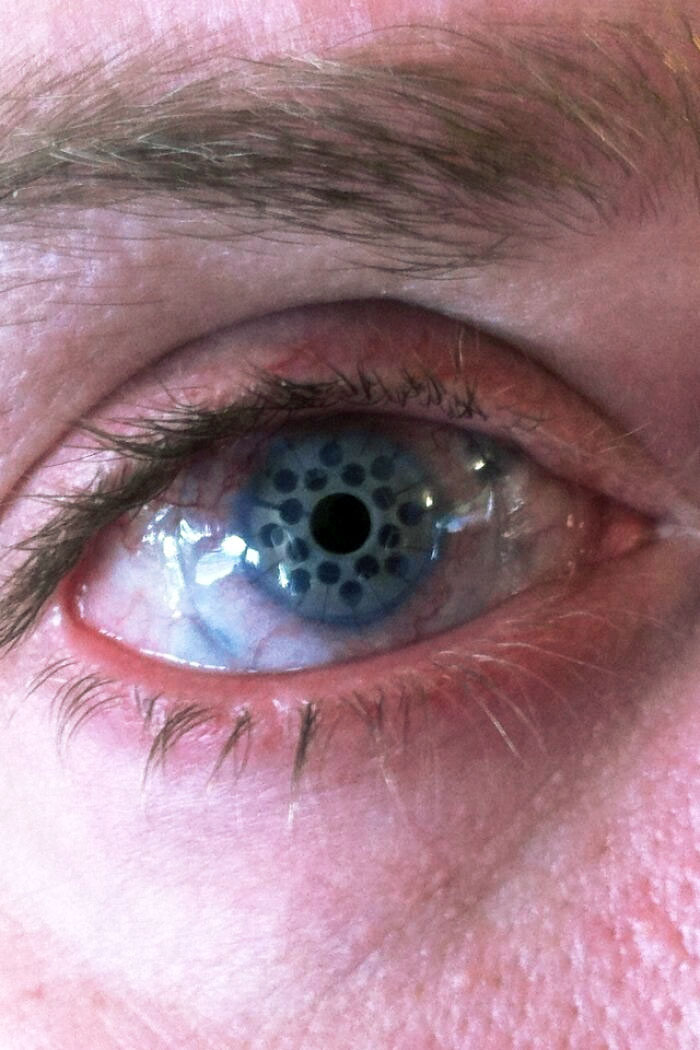 Close-up of a human eye with an unusual patterned iris, illustrating fascinating and disturbing medical photos.