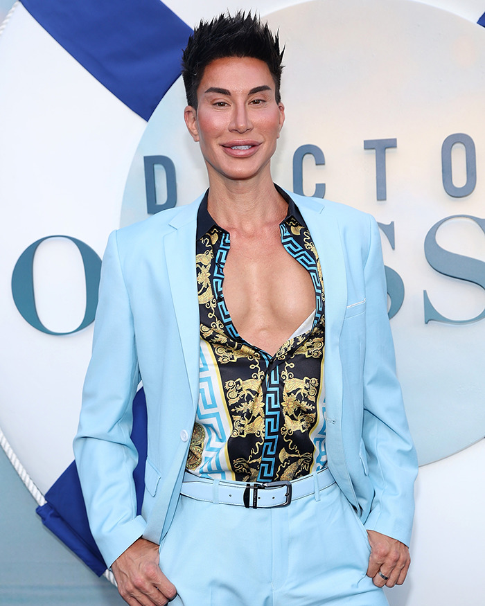 Person with extreme plastic surgery wearing a light blue suit and patterned shirt posing at an event backdrop.