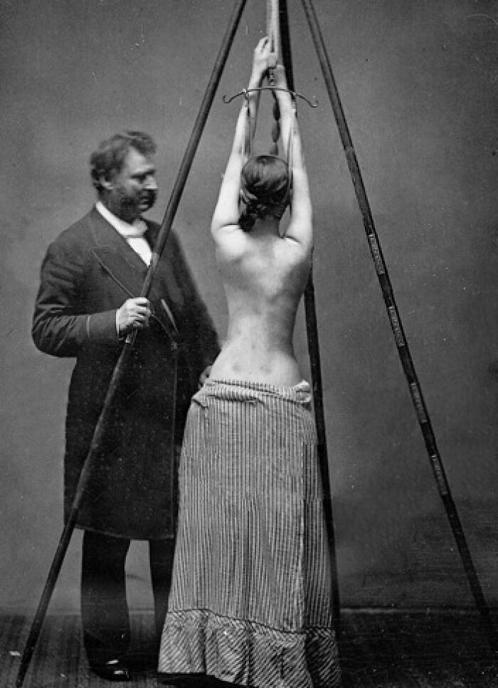Vintage black and white photo showing a woman restrained in an unsettling medical device from the past with a man observing.