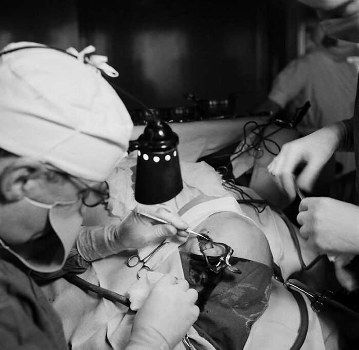 Black and white image of surgeons using unsettling medical devices from the past during a knee operation in a vintage surgical setting.
