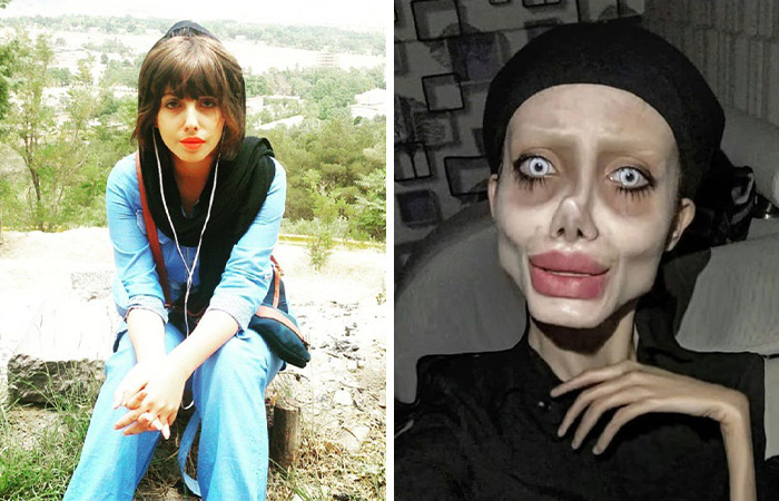 Comparison of two women before and after extreme plastic surgery showing transformation of normal people to fame.