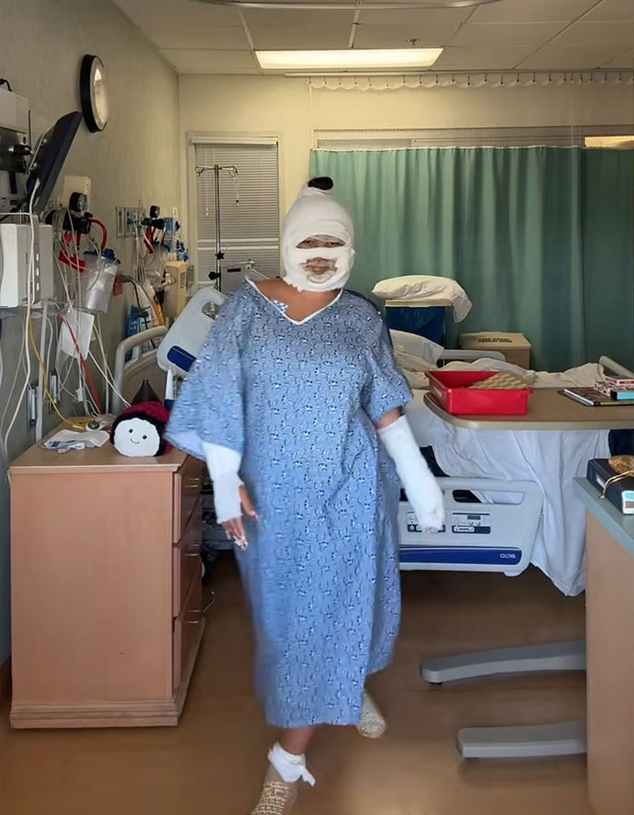 Teen with bandaged face and hands walks in hospital room after disfiguring injuries from s’mores-making accident. - 3