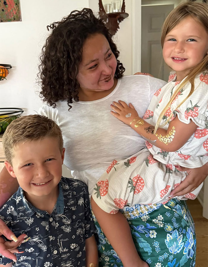 Teen with visible facial injuries smiling and holding two young children, highlighting s’mores-making accident product attorney needs. Teen with visible facial injuries smiling and holding two young children, highlighting s’mores-making accident product attorney needs.