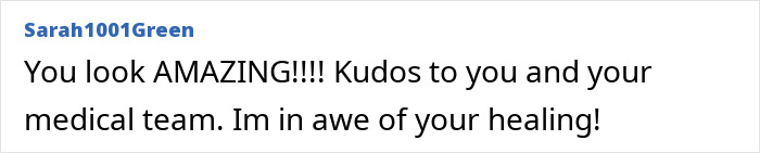 Comment praising a woman burned in a gas station explosion, expressing awe at her healing and transformation. - 25